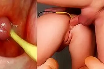 Amazing Anal Camera In Her Ass Deep Anal Fuck And Internal Creampie - Sergy Loven - porn video